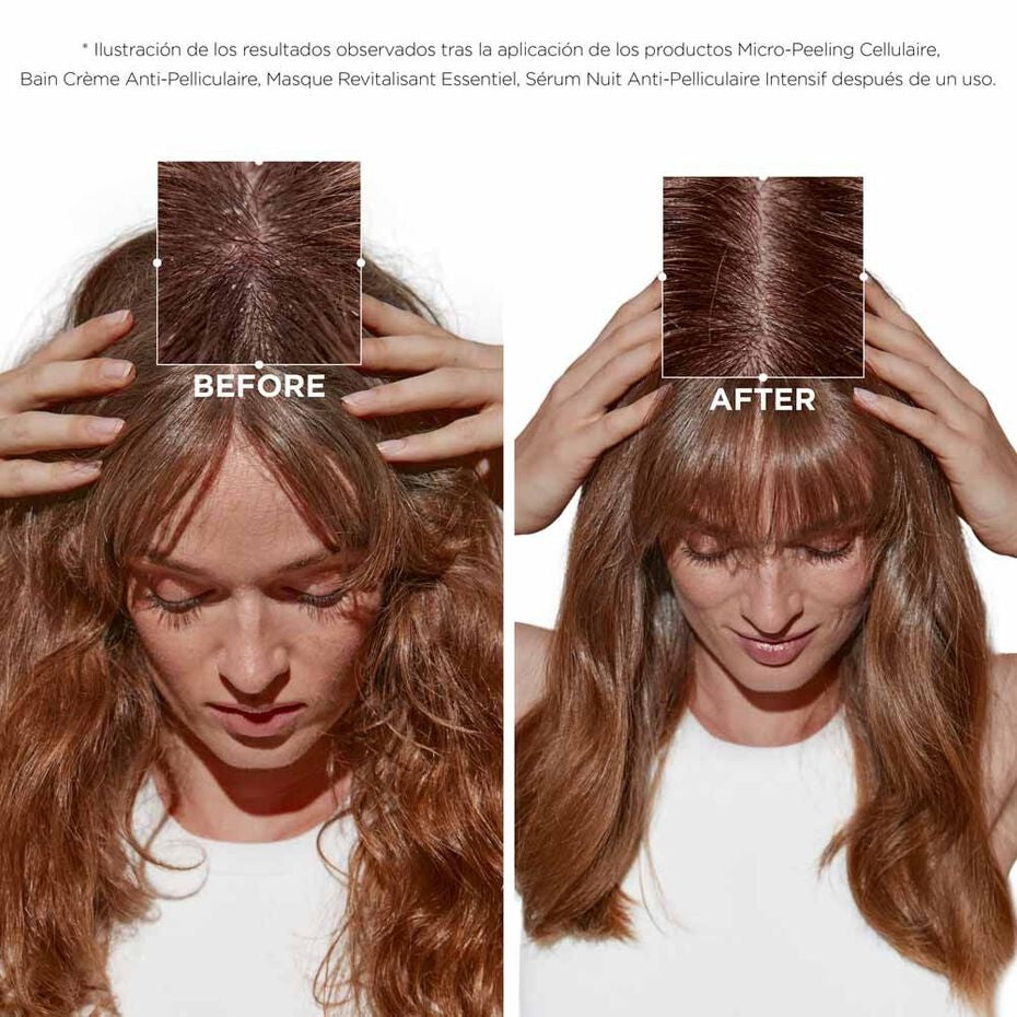 Micro-Peeling Cellulaire 200 ml